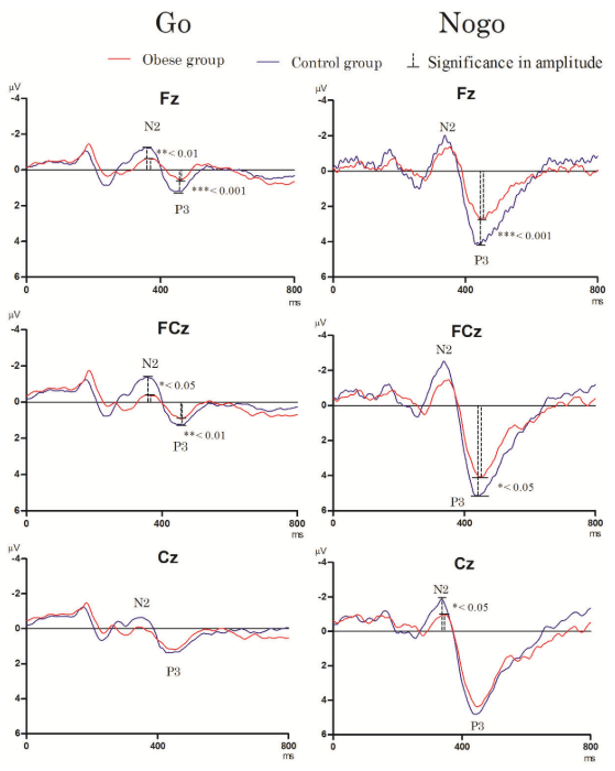 脑电 Go/Nogo任务